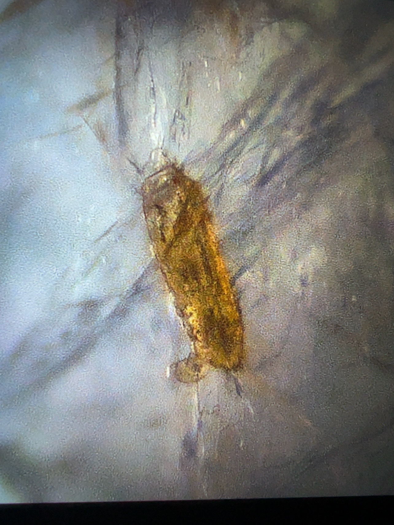 Bleeding-like internal inclusion in a treated ruby under microscopic illumination
